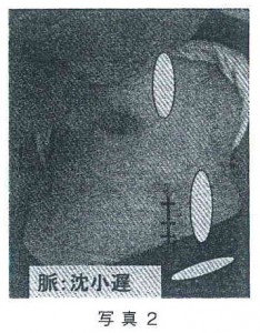 脈:沈小遅